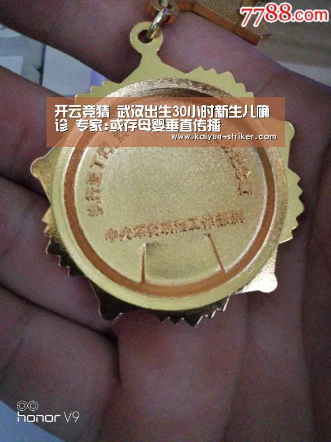 开云竞猜_武汉出生30小时新生儿确诊 专家:或存母婴垂直传播(图1) 开云直播